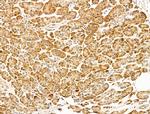EEF1E1 Polyclonal Antibody