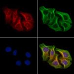 AKAP4 Polyclonal Antibody