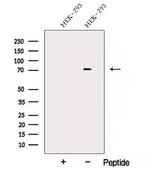 AKAP8L Polyclonal Antibody
