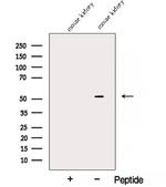 ALDH5A1 Antibody in Western Blot (WB)