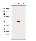 ALDH5A1 Antibody in Western Blot (WB)