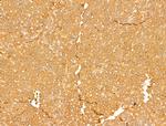 ALDH9A1 Antibody in Immunohistochemistry (Paraffin) (IHC (P))