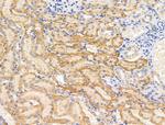 Spectrin alpha-1 Antibody in Immunohistochemistry (Paraffin) (IHC (P))