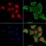 AMPK beta-1 Polyclonal Antibody