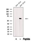 ANGPTL2 Polyclonal Antibody