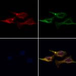 AP3M1 Polyclonal Antibody