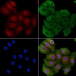 APBA1 Polyclonal Antibody