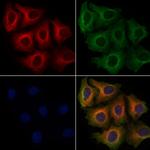 RIAM Polyclonal Antibody