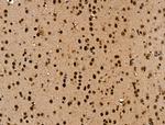 APC7 Antibody in Immunohistochemistry (Paraffin) (IHC (P))