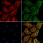 ApoC3 Polyclonal Antibody