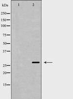 Aquaporin 0 Polyclonal Antibody