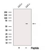ARIH2 Antibody in Western Blot (WB)