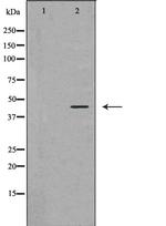 Ataxin 3 Polyclonal Antibody