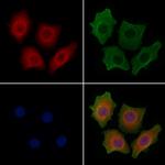 ATF6 Polyclonal Antibody