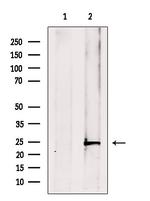 V-ATPase E1 Antibody in Western Blot (WB)