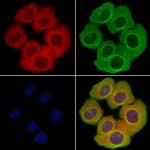 BAFF (BLyS) Polyclonal Antibody