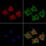 BAGE2 Polyclonal Antibody