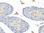 BAGE2 Antibody in Immunohistochemistry (Paraffin) (IHC (P))