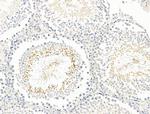 BAGE2 Antibody in Immunohistochemistry (Paraffin) (IHC (P))