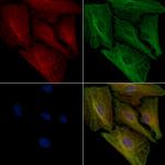 BAIAP2L1 Polyclonal Antibody