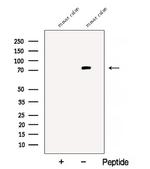 Bestrophin 3 Polyclonal Antibody