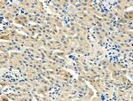 BHMT Polyclonal Antibody