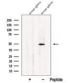 BLMH Polyclonal Antibody