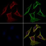 GDF10 Polyclonal Antibody