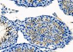 IBSP Antibody in Immunohistochemistry (Paraffin) (IHC (P))
