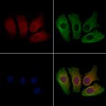 ATAT1 Polyclonal Antibody