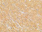 ATAT1 Antibody in Immunohistochemistry (Paraffin) (IHC (P))