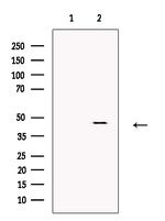 ATAT1 Antibody in Western Blot (WB)
