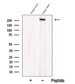 CACNA1B Polyclonal Antibody