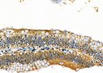 CGRP Antibody in Immunohistochemistry (Paraffin) (IHC (P))