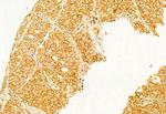 Calnexin Antibody in Immunohistochemistry (Paraffin) (IHC (P))