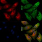 Calreticulin 3 Polyclonal Antibody