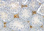 Calreticulin 3 Antibody in Immunohistochemistry (Paraffin) (IHC (P))