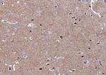CaMKII alpha/delta Polyclonal Antibody