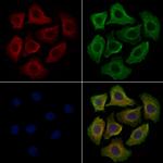 CaMKII delta Polyclonal Antibody