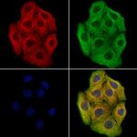 CAP1 Antibody in Immunocytochemistry (ICC/IF)