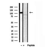 GPIP137 Antibody in Western Blot (WB)