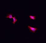 CK1 alpha Polyclonal Antibody