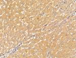 SLC7A1 Polyclonal Antibody