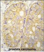 POTED Polyclonal Antibody