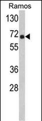 POTED Antibody in Western Blot (WB)