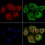 CCDC28A Polyclonal Antibody