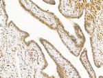 CCDC28A Antibody in Immunohistochemistry (Paraffin) (IHC (P))