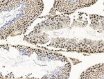 CCDC28A Antibody in Immunohistochemistry (Paraffin) (IHC (P))