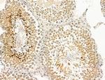 CCDC34 Antibody in Immunohistochemistry (Paraffin) (IHC (P))