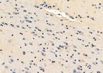 Eotaxin Polyclonal Antibody